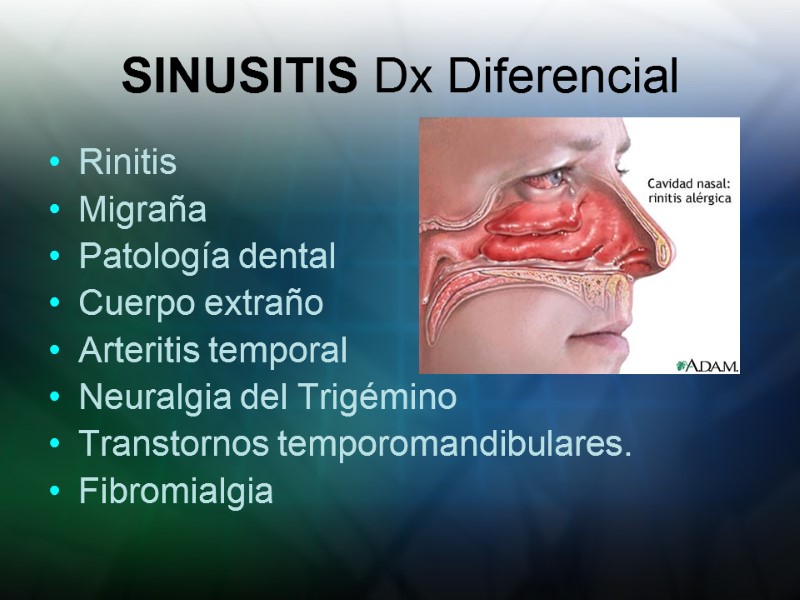 SINUSITIS Dx Diferencial Rinitis Migraña Patología dental Cuerpo extraño Arteritis temporal Neuralgia del Trigémino